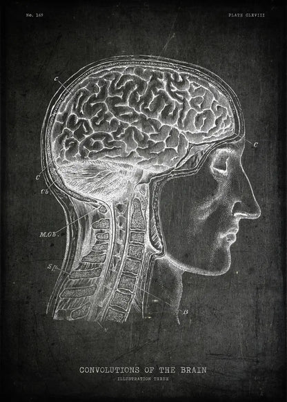 Anatomical illustration of the brain and skull on a dark background